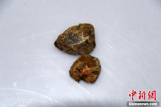 Қытайдағы қазба деректер адамның ортаңғы құлағы балықтың желбезегінен өзгергенін алғаш рет көрсетті